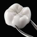 What materials are used in biological dentistry?